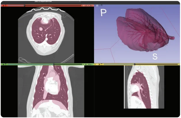 3D Volume Rendering - multi-planar medical imaging views