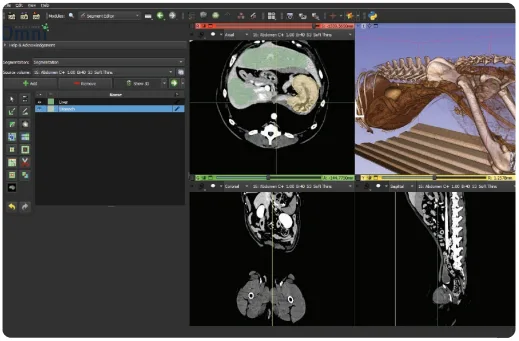 Segmentation Editor - 3D anatomical view with editing tools