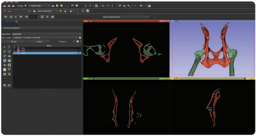 3D Multi-Planar Reconstruction with segmentation editor