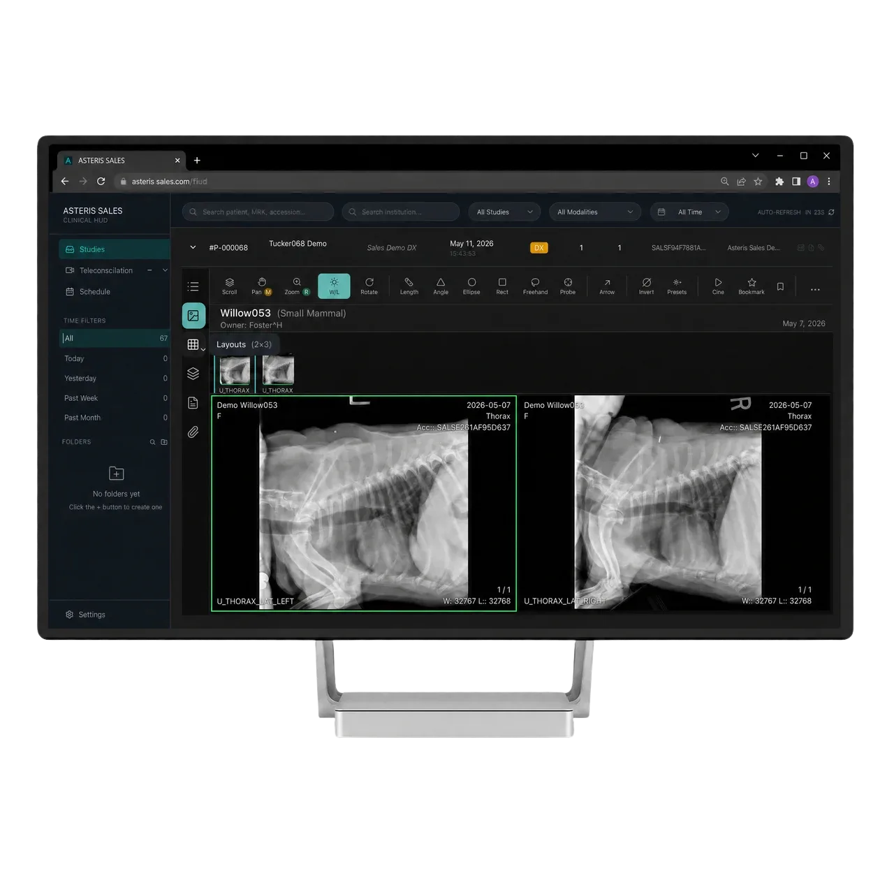 NewLumen browser viewer