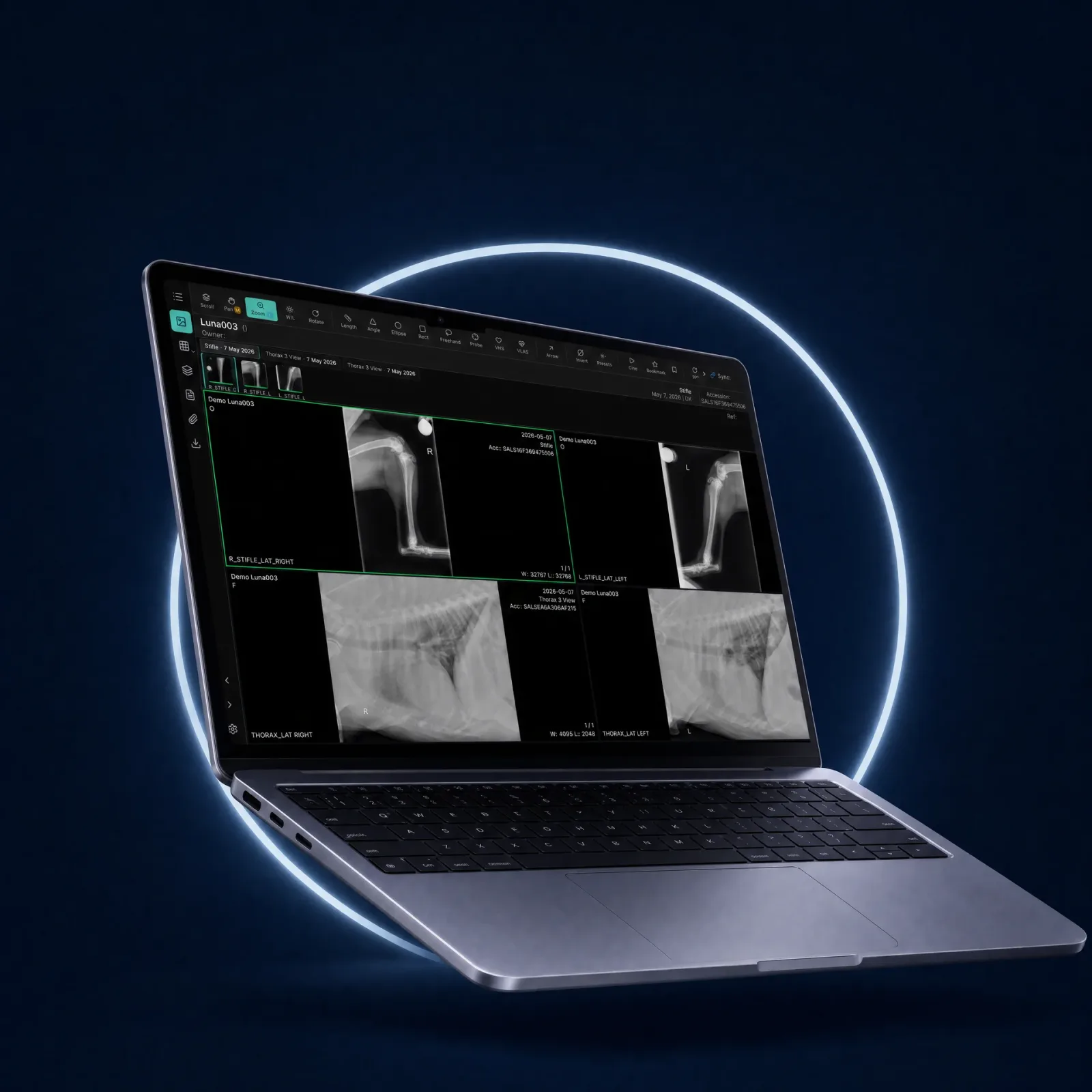 NewLumen viewer open on a laptop showing stifle and thorax radiographs