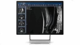 DICOM Viewer