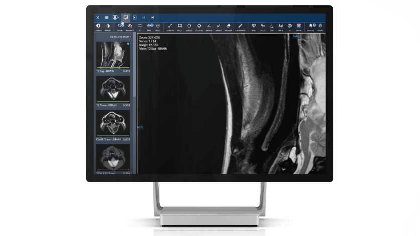 DICOM Viewer